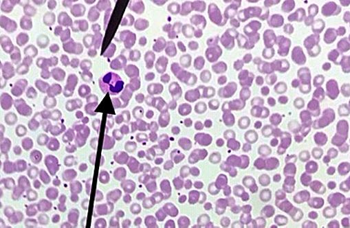 eosinophil