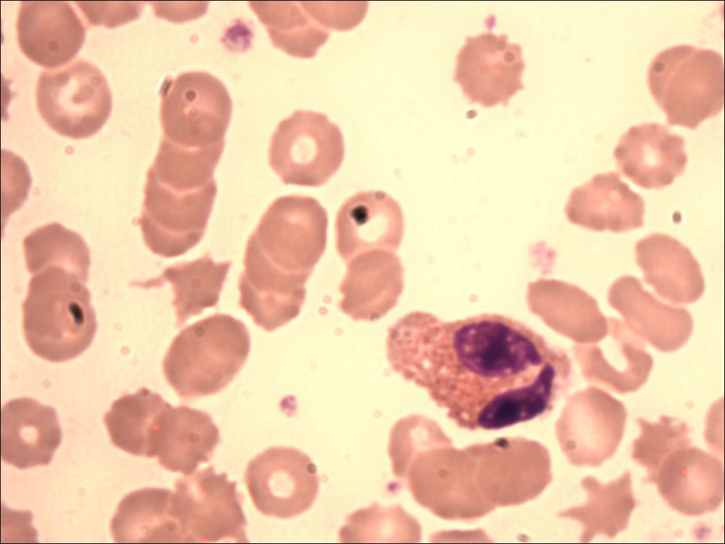 eosinophil