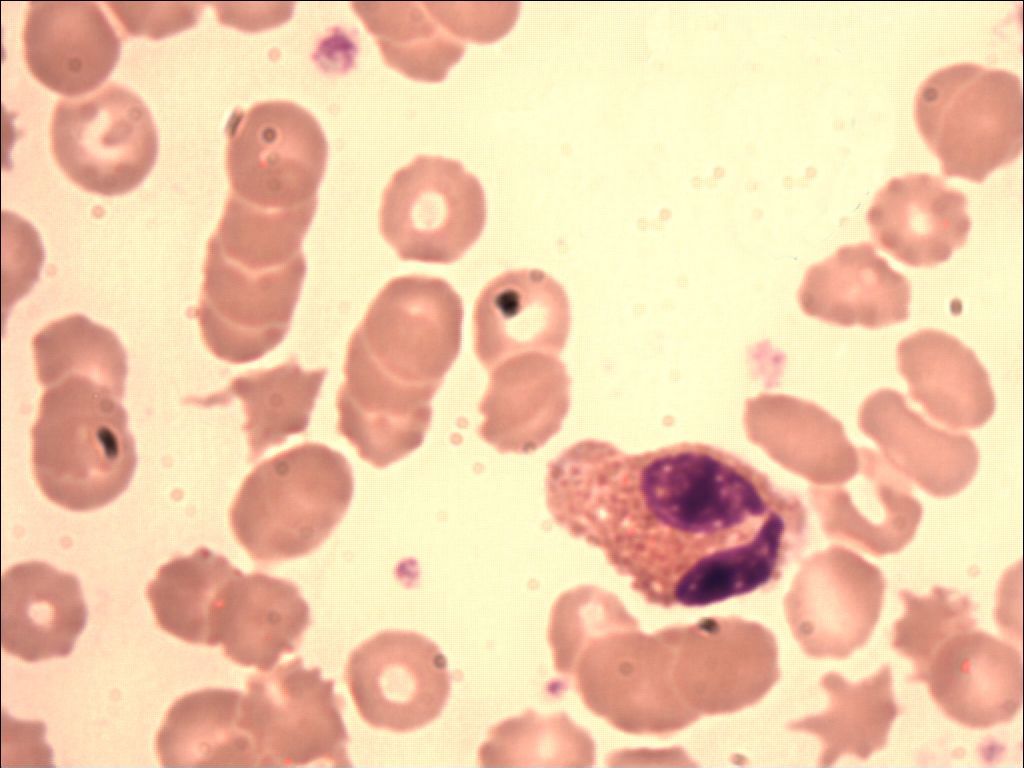 eosinophil