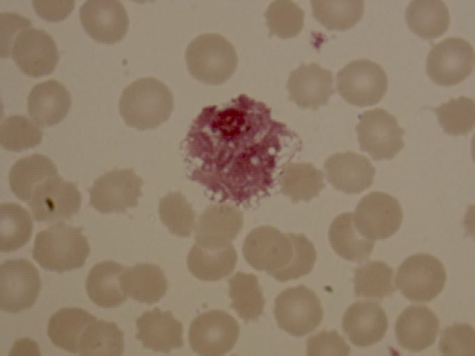 eosinophil