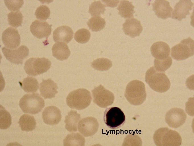 lymphocytel