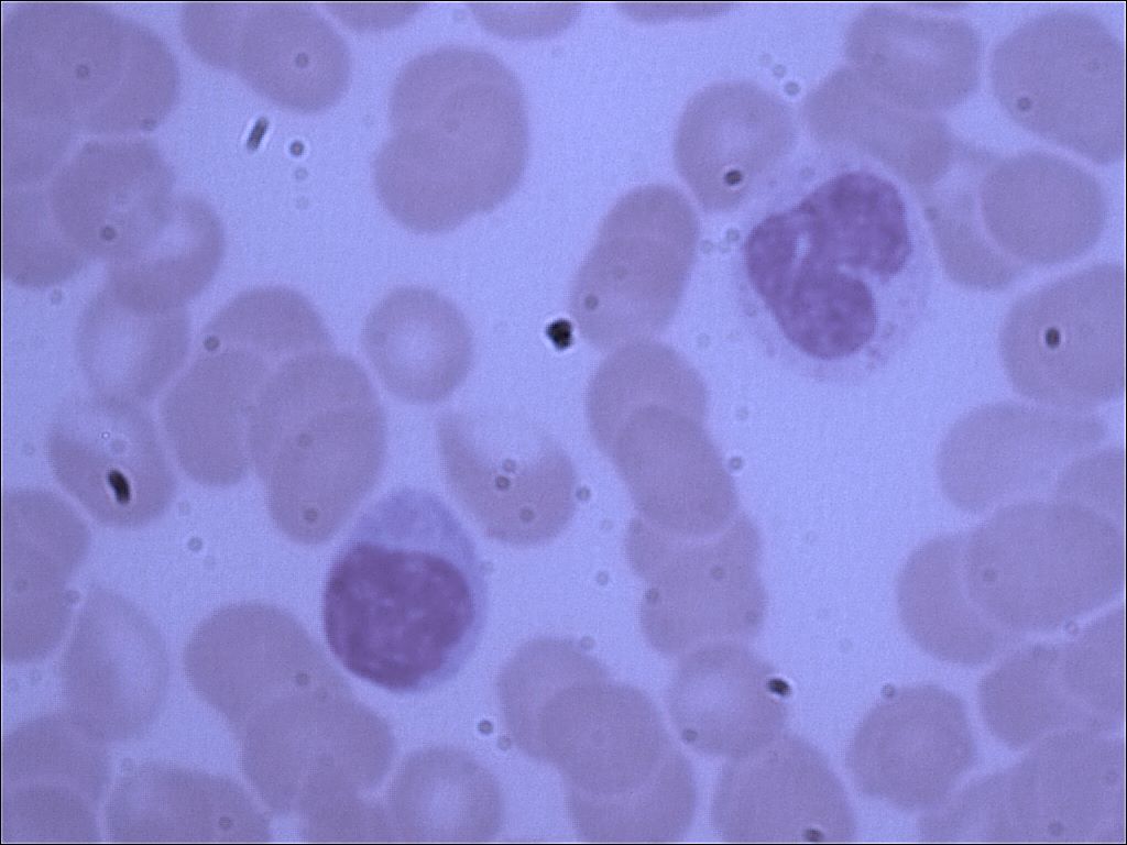 lymphocytel