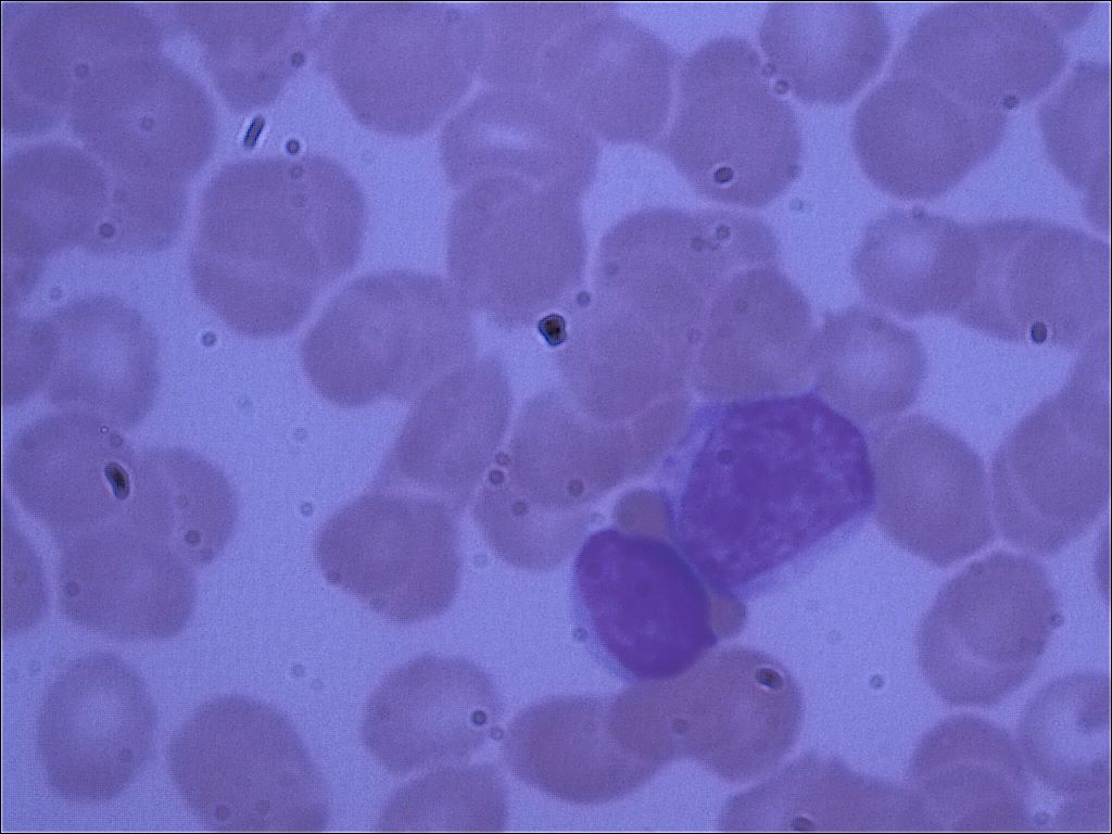 lymphocytel