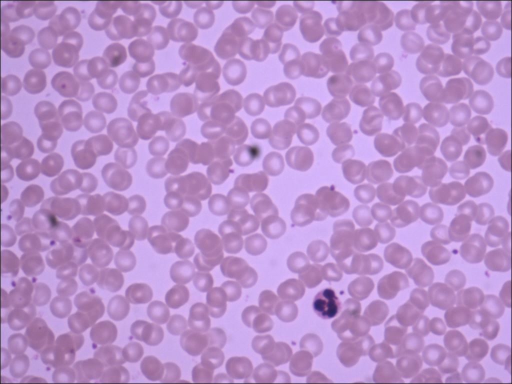 neutrophil