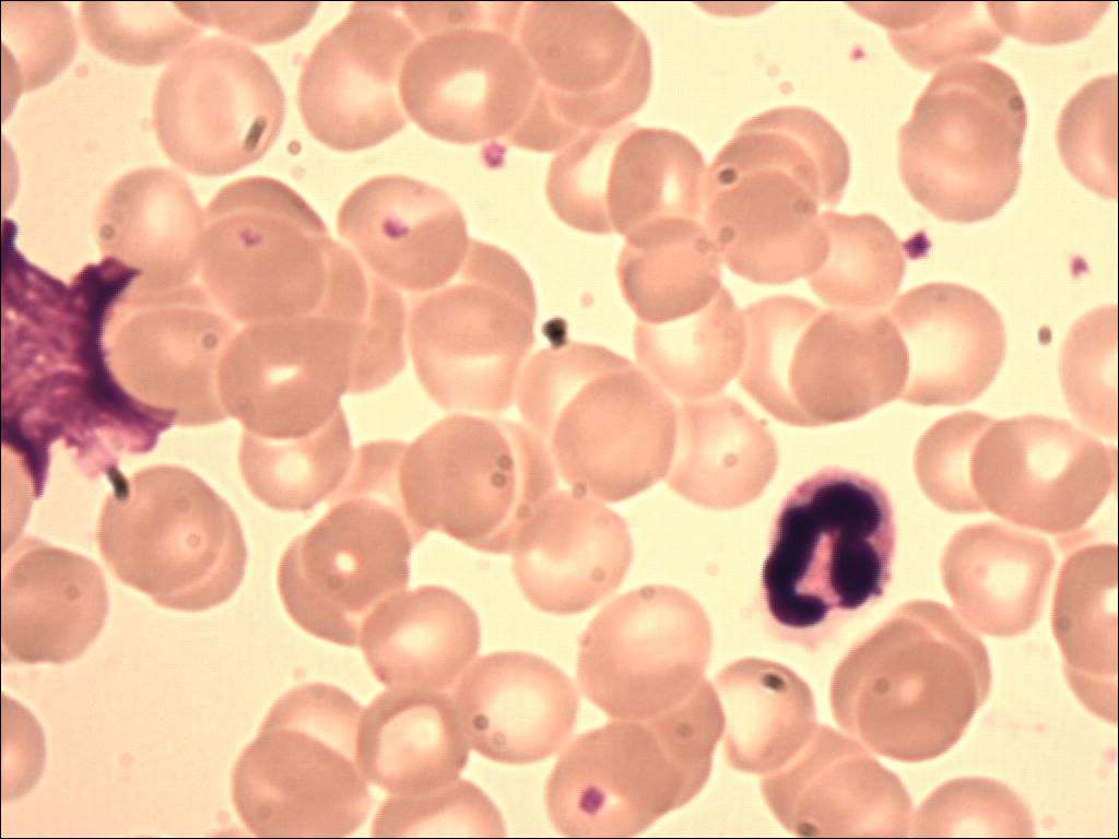 neutrophil