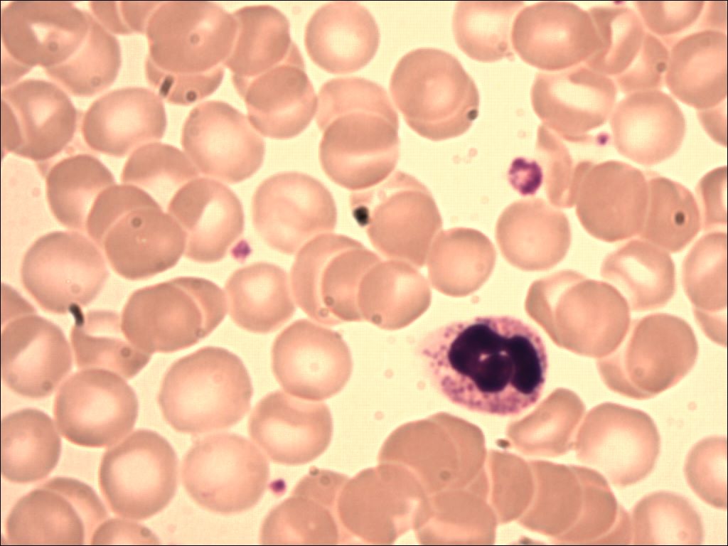 neutrophil