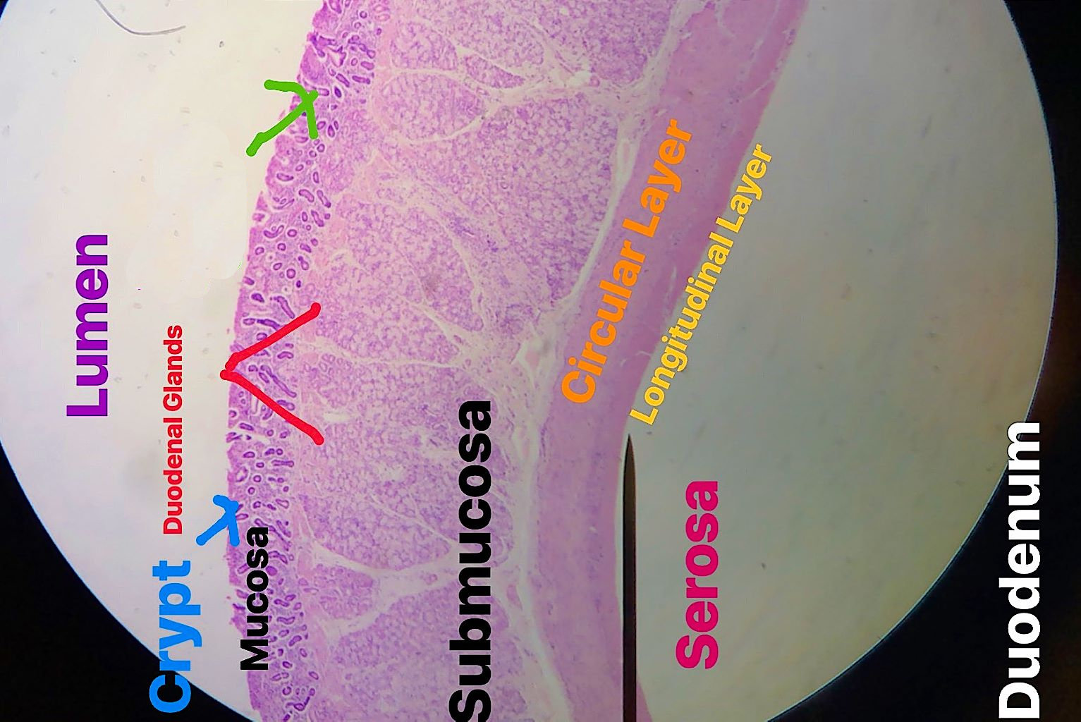 duodenum