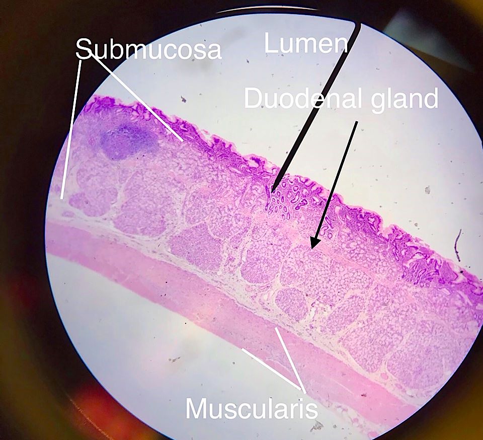 duodenum