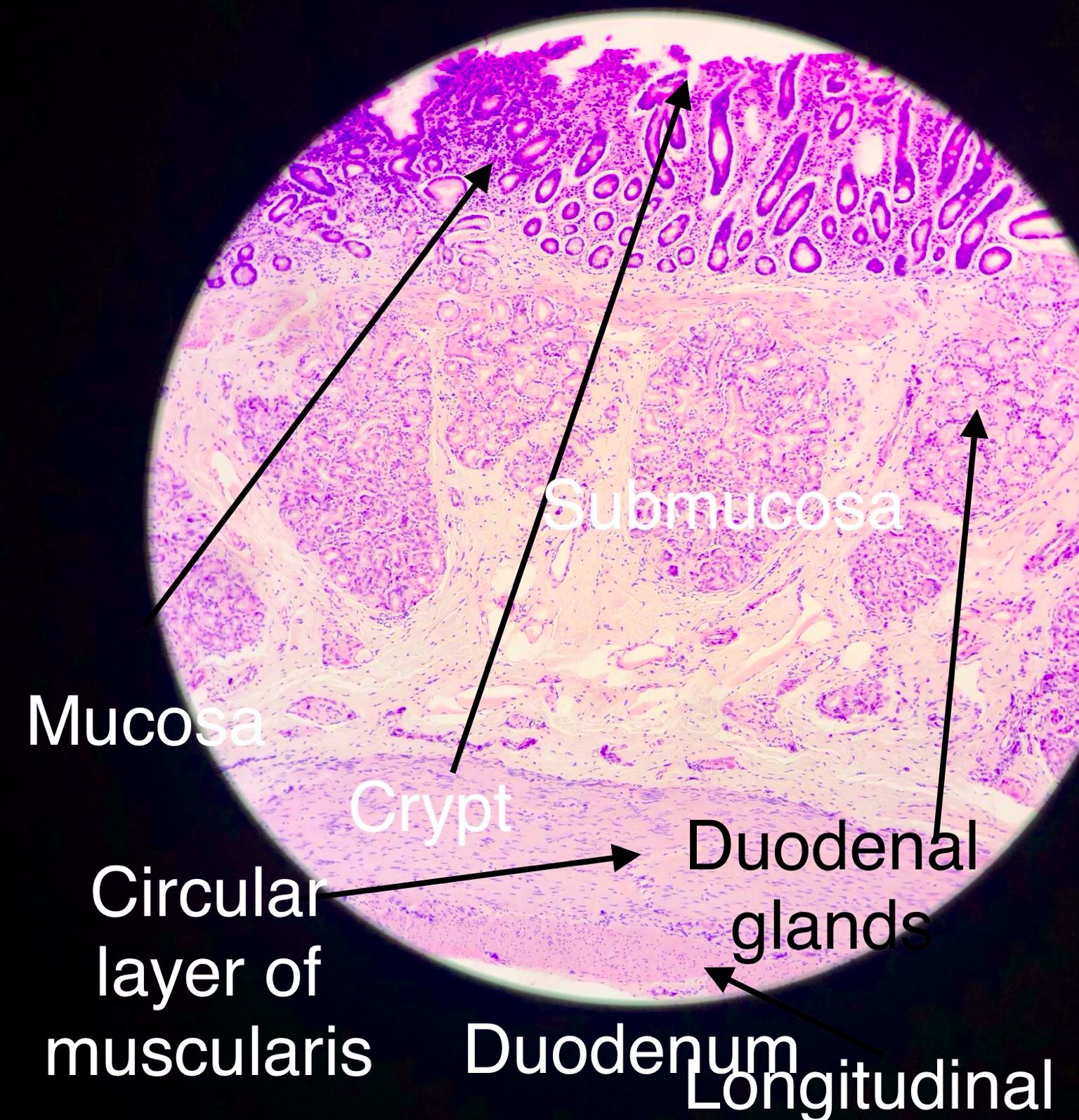 duodenum