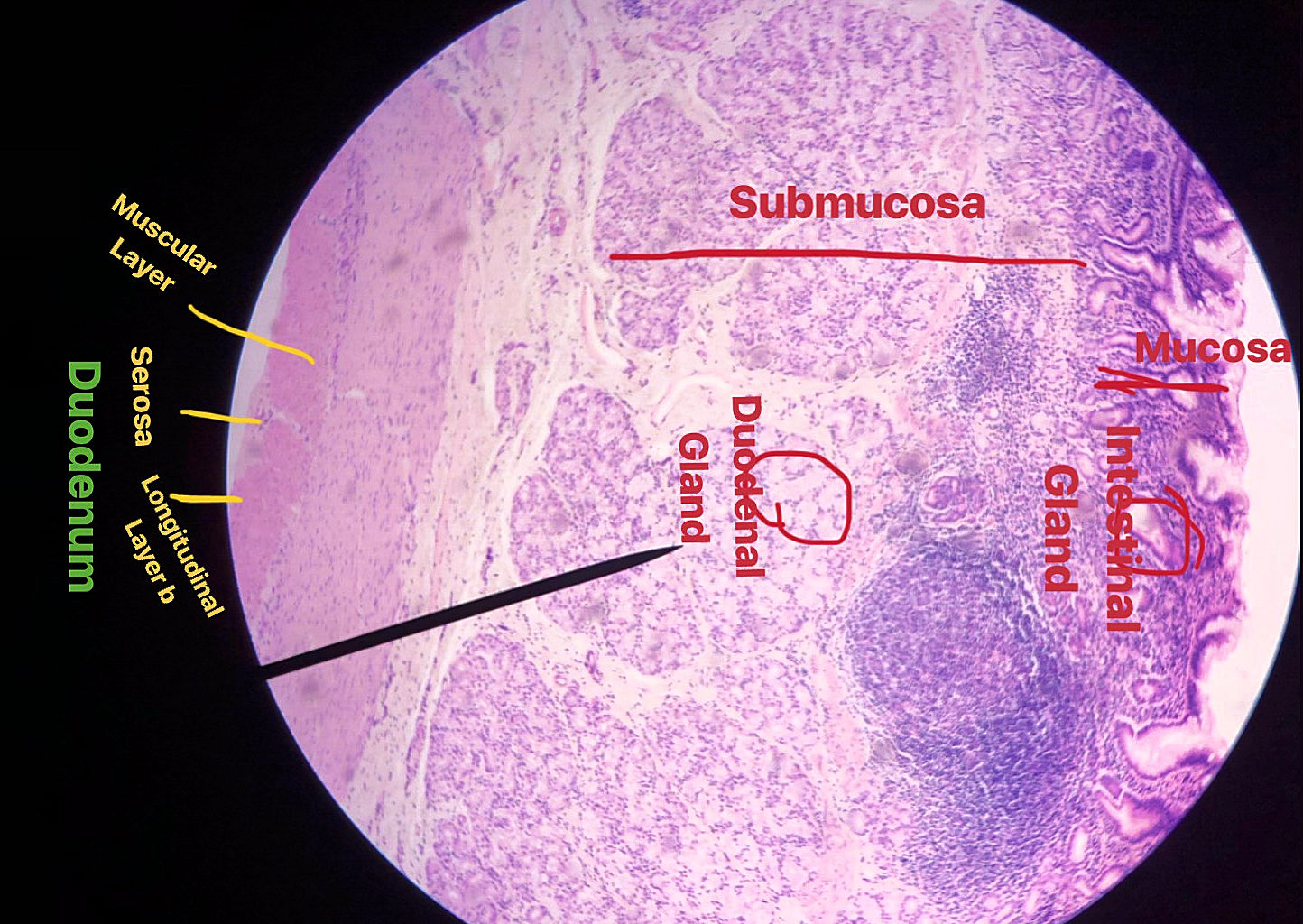 duodenum