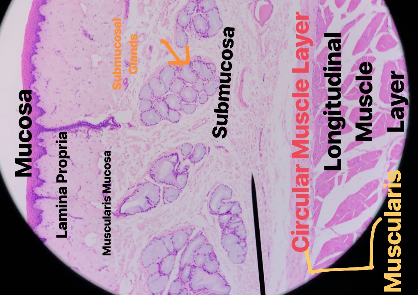 esophagus