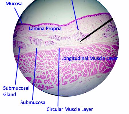 esophagus