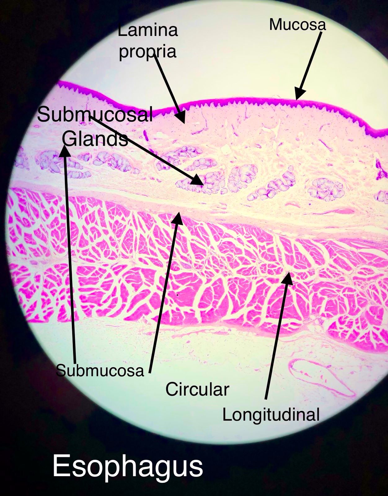 esophagus