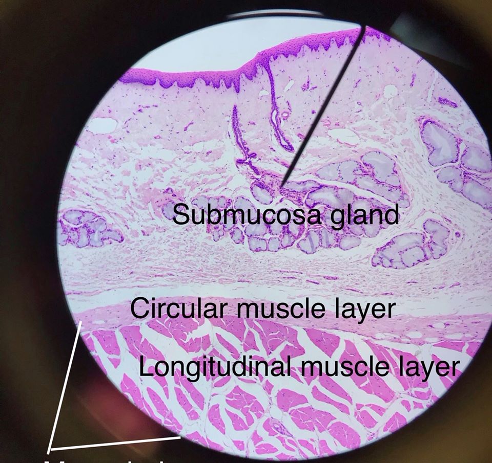 esophagus