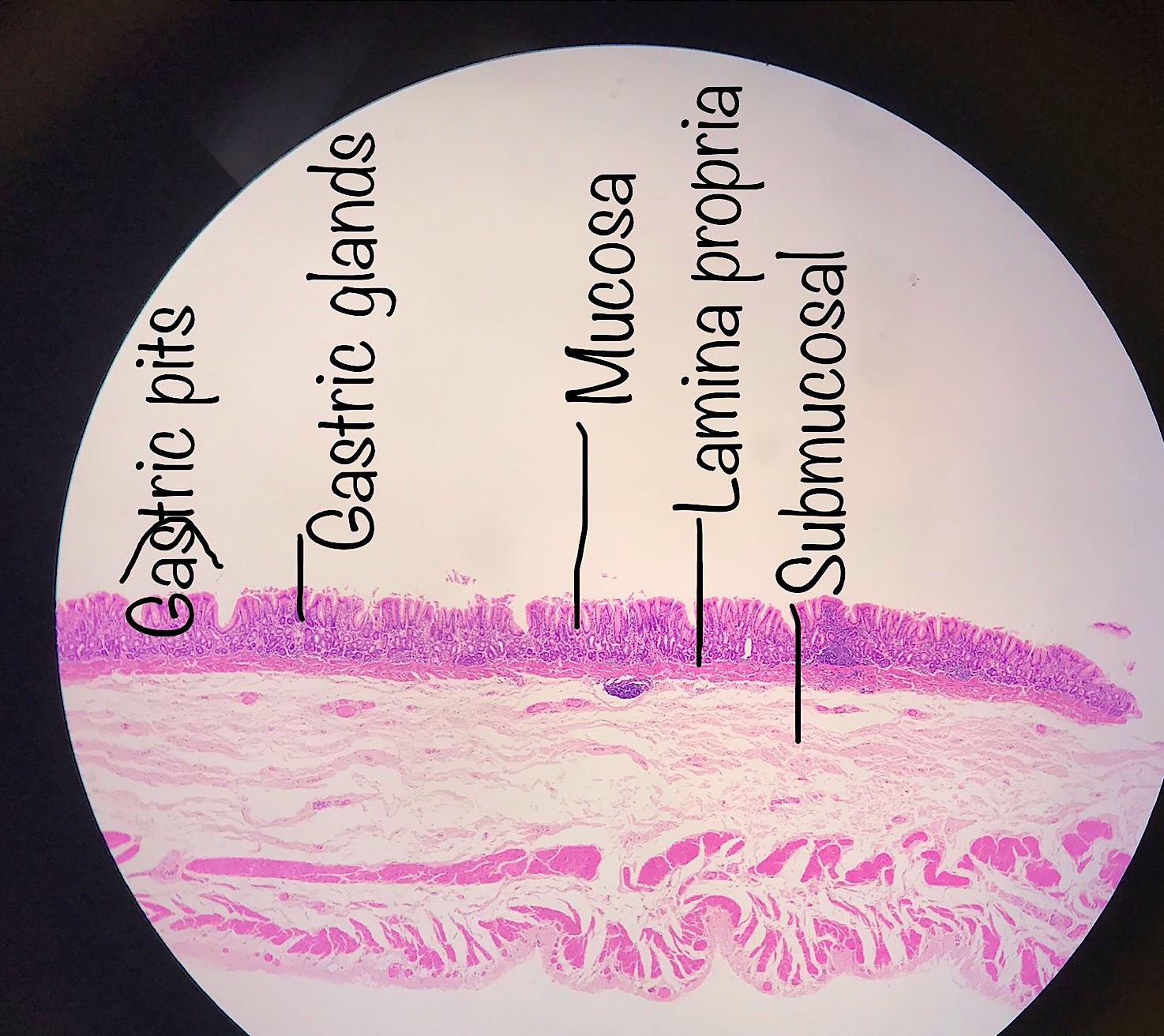 esophagus