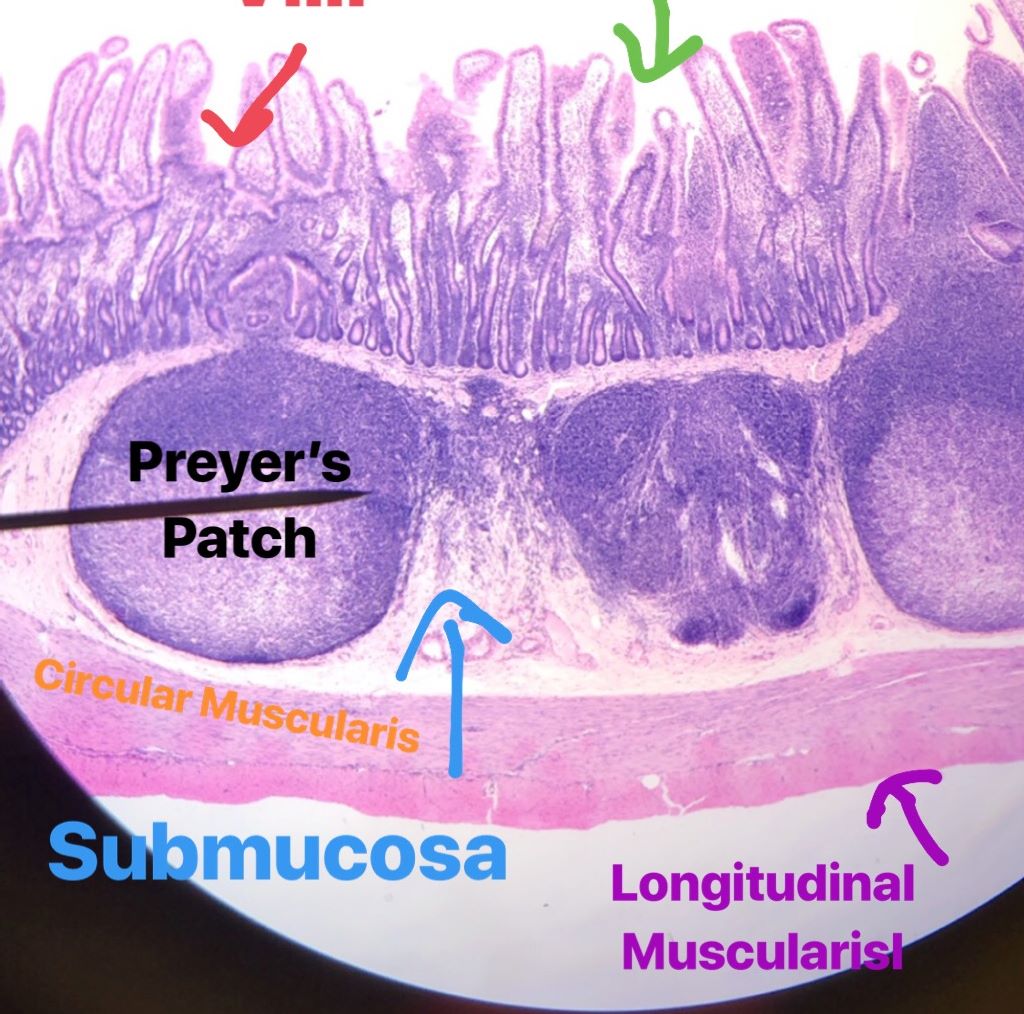 duodenum