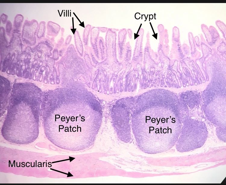 duodenum