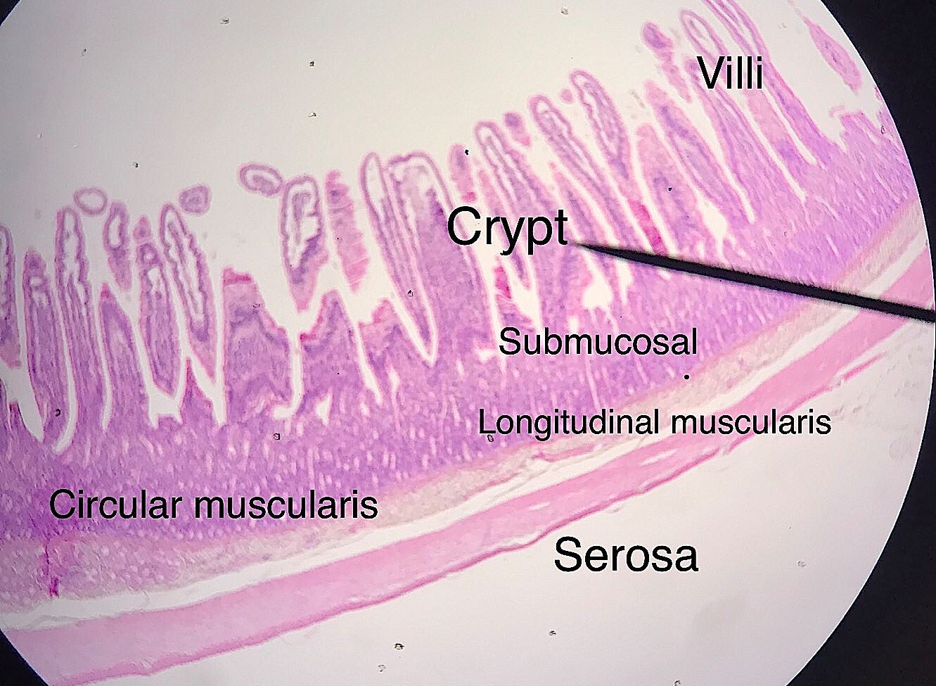 jejunum