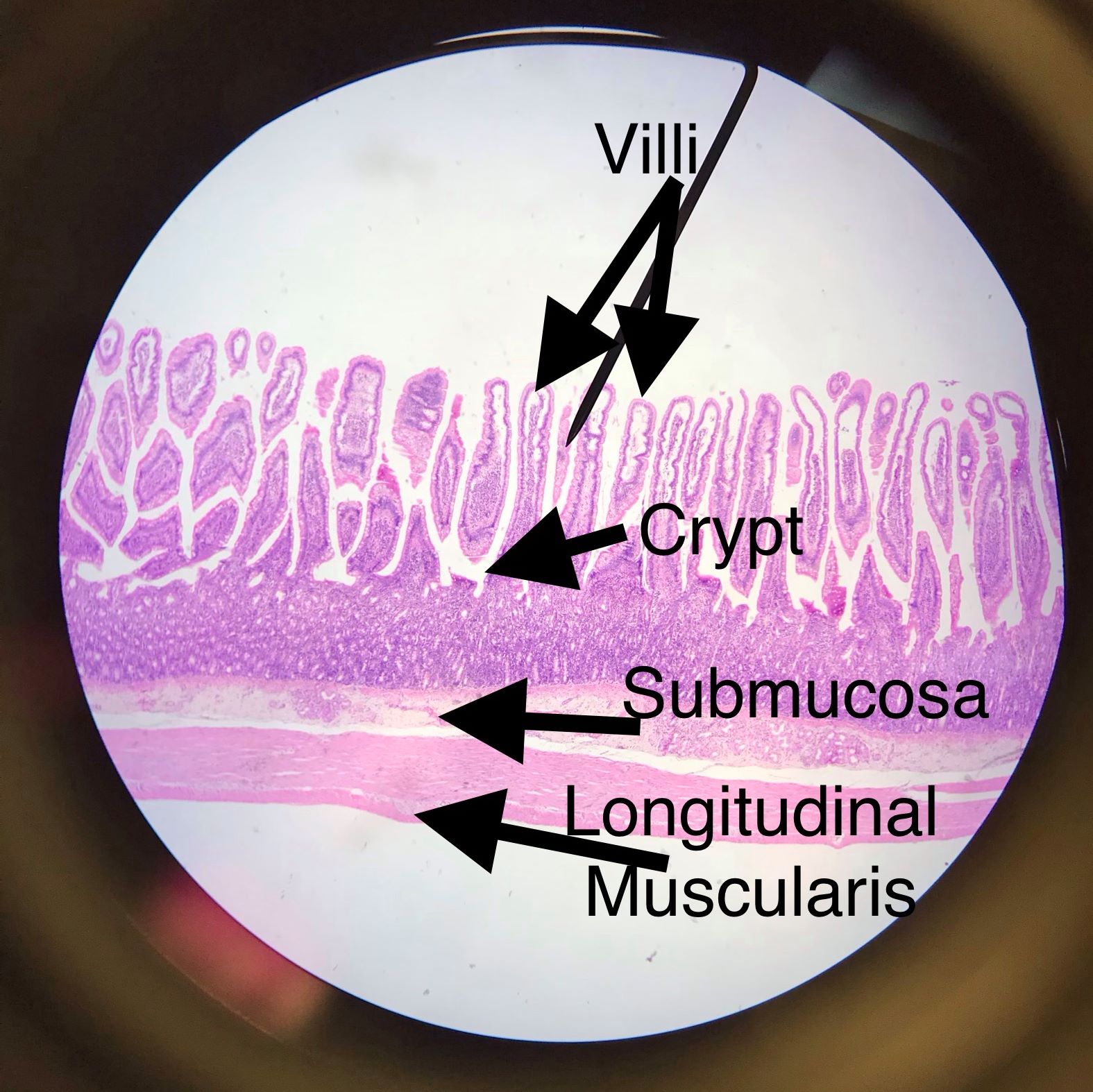 jejunum