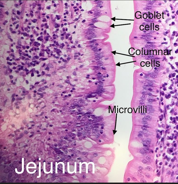 jejunum