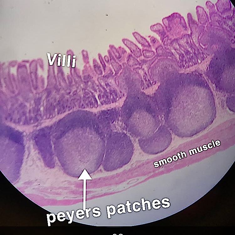 duodenum