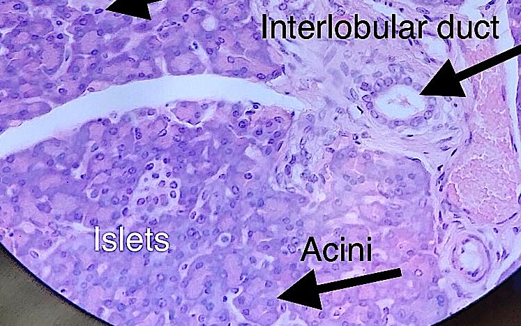 pancreas