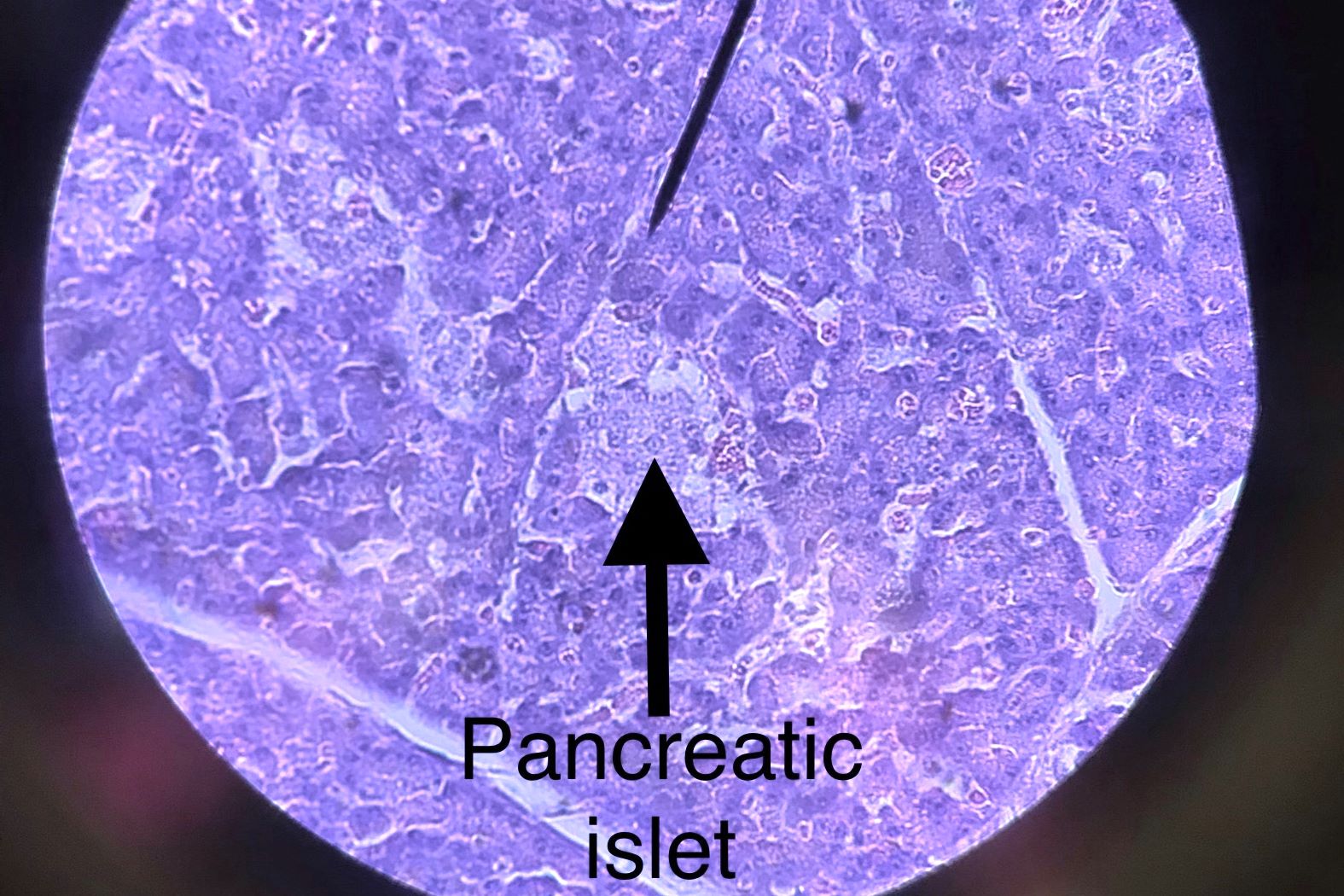 pancreas