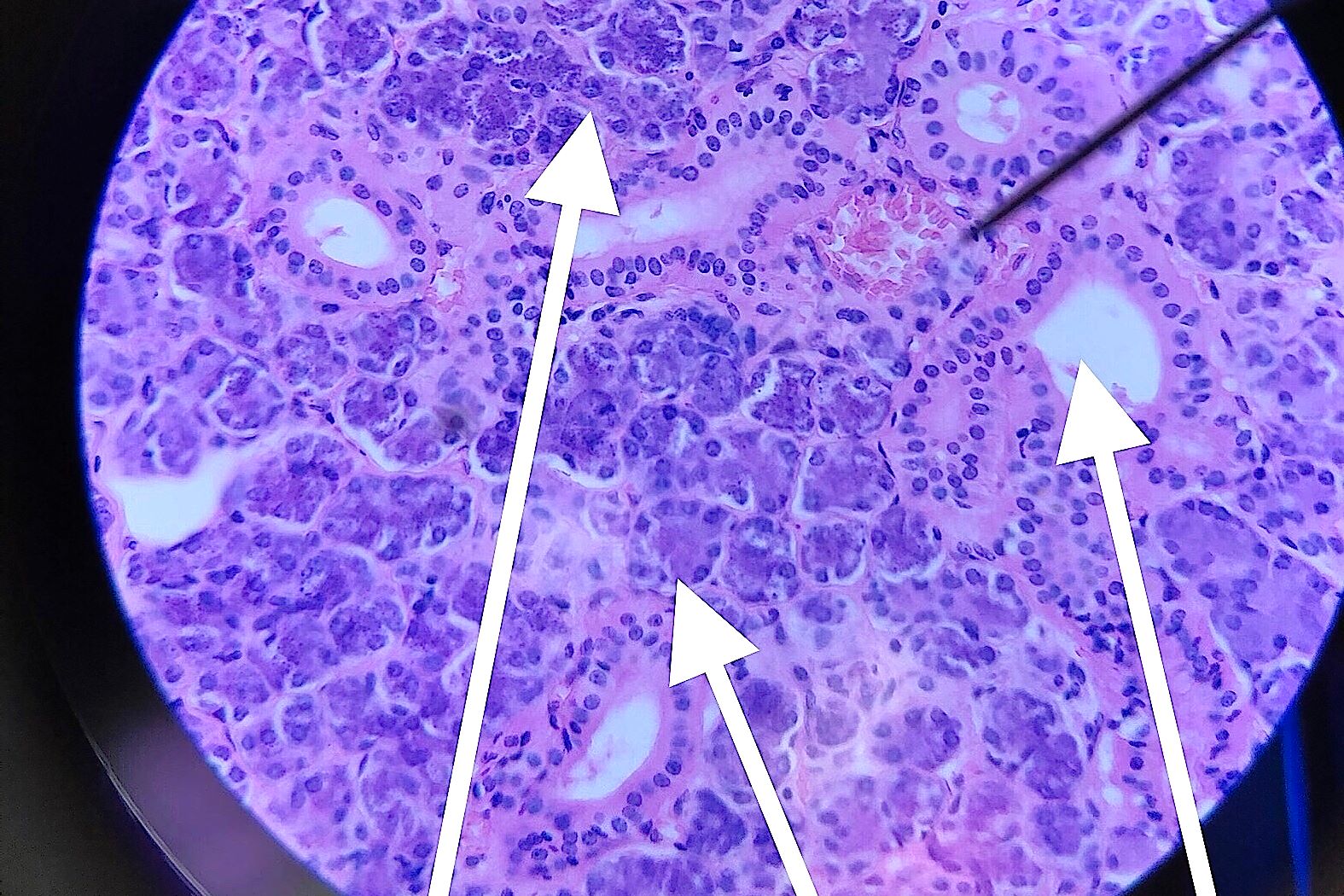 submandibular gland