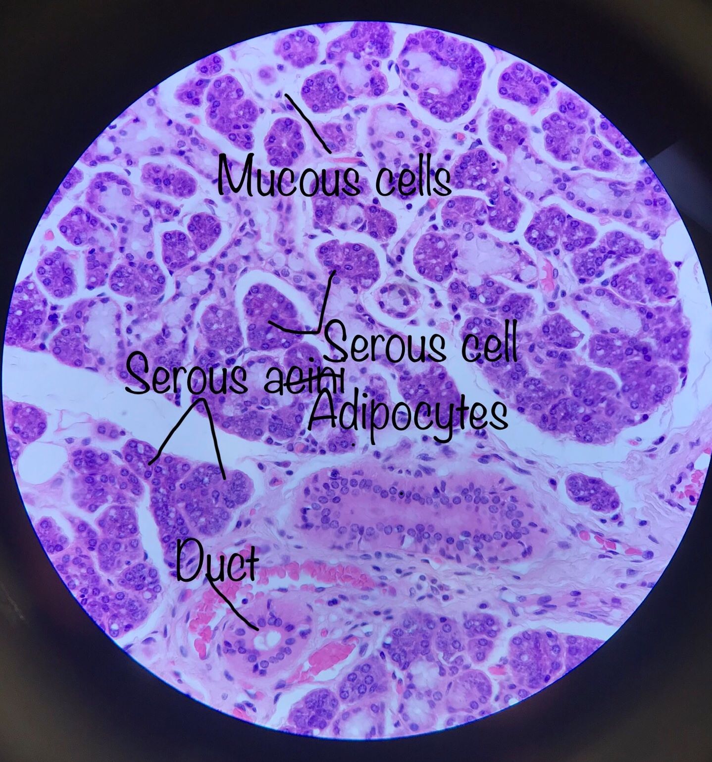 submandibular gland