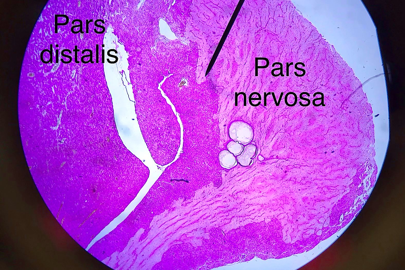 Pituitary low