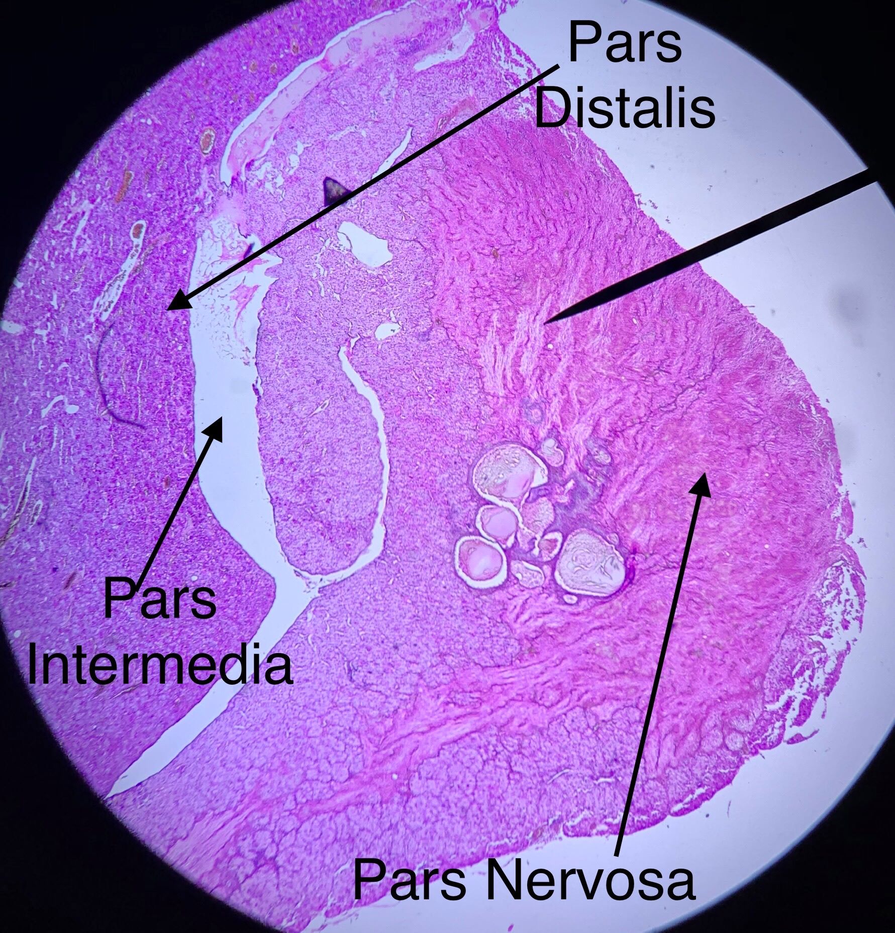 Pituitary low