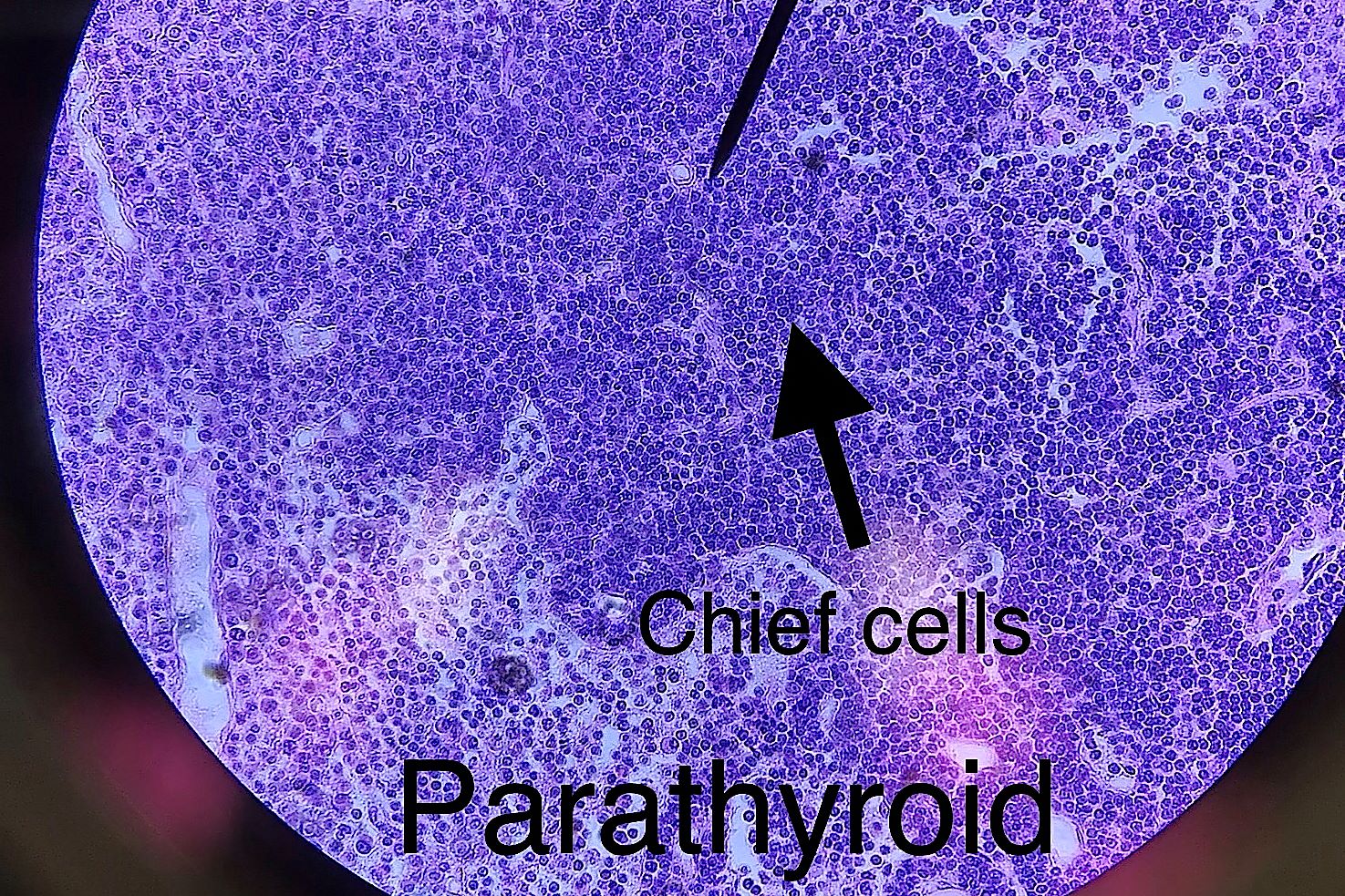 parahyroid  Gland