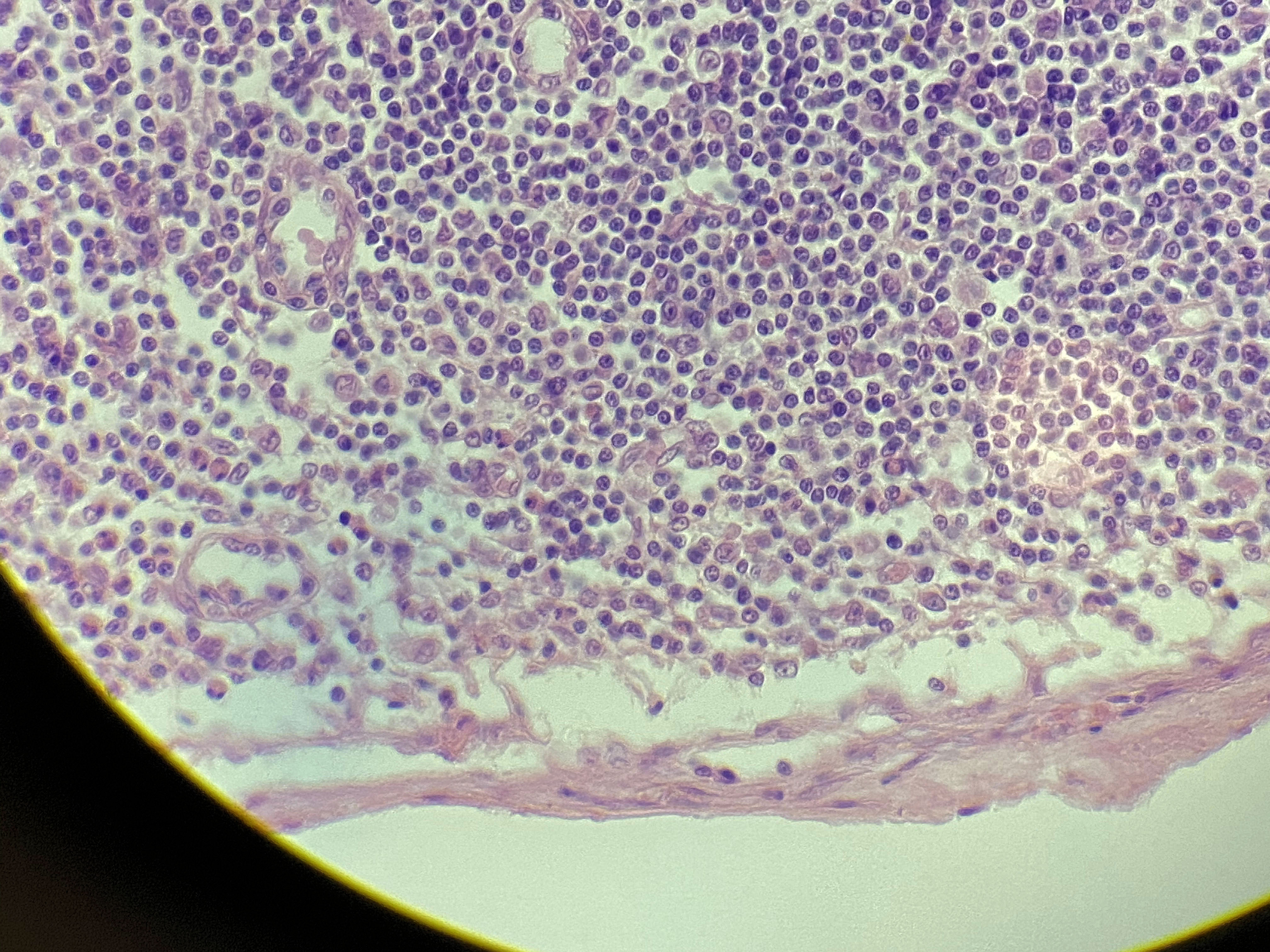 parahyroid  Gland