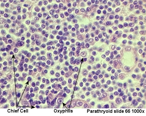 parathyroid labeled 