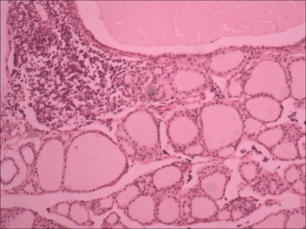 Thyroid Gland