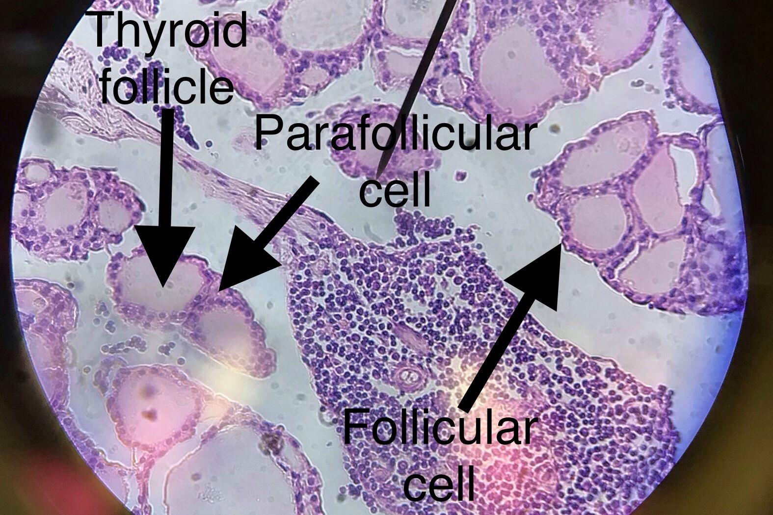 Thyroid Gland