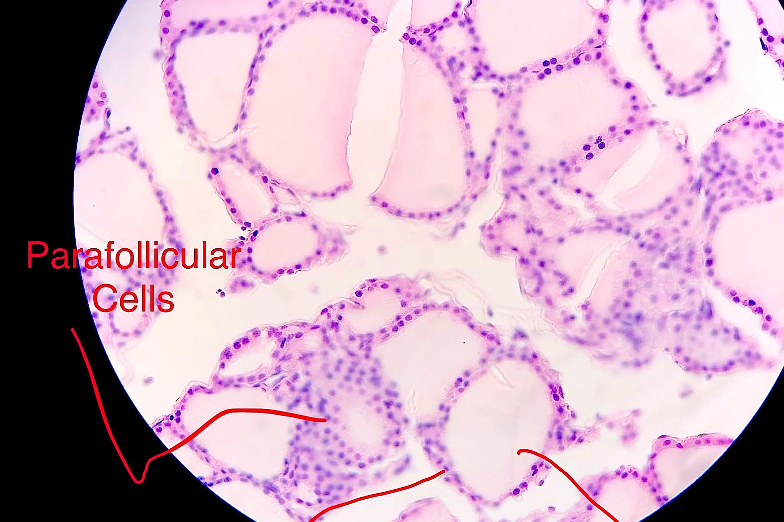 Thyroid  Gland