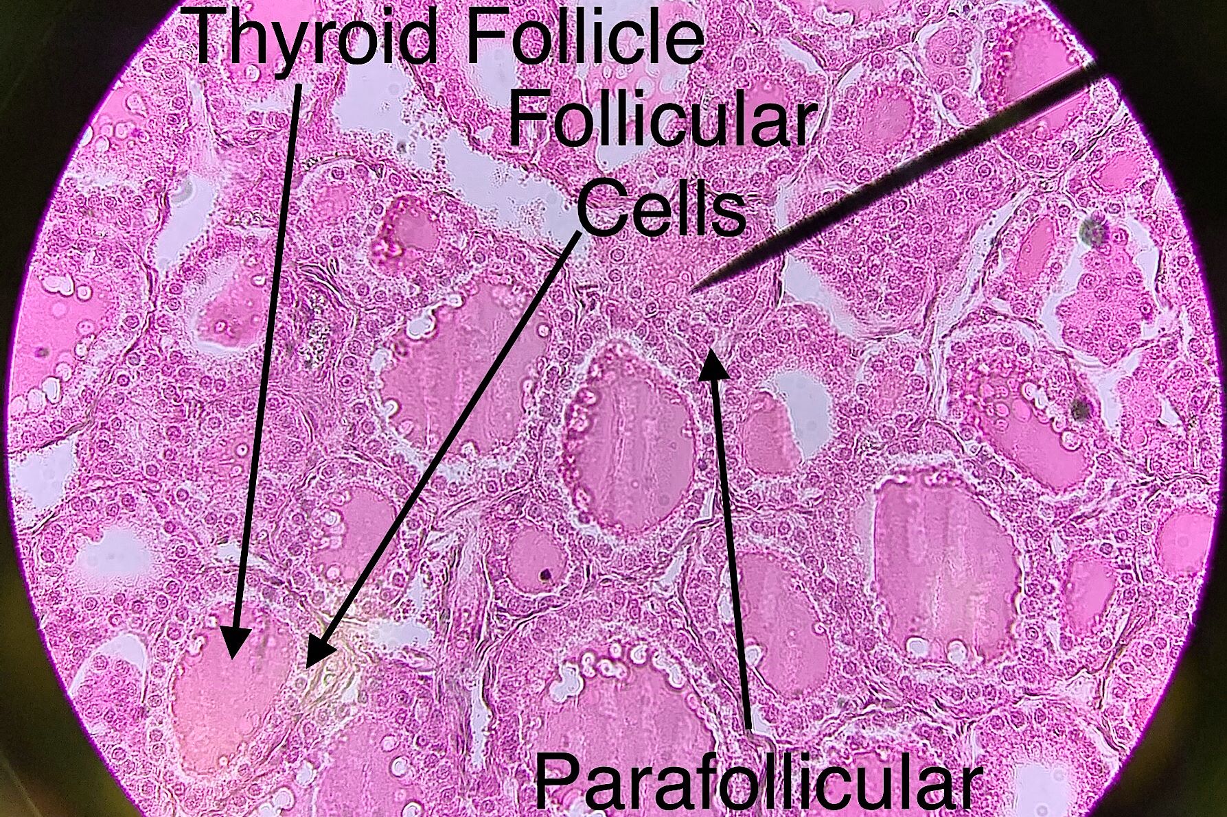 Thyroid Gland