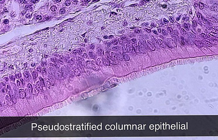 pseudostratified columnar epithelium