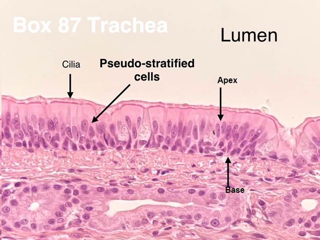 pseudostratified columnar epithelium