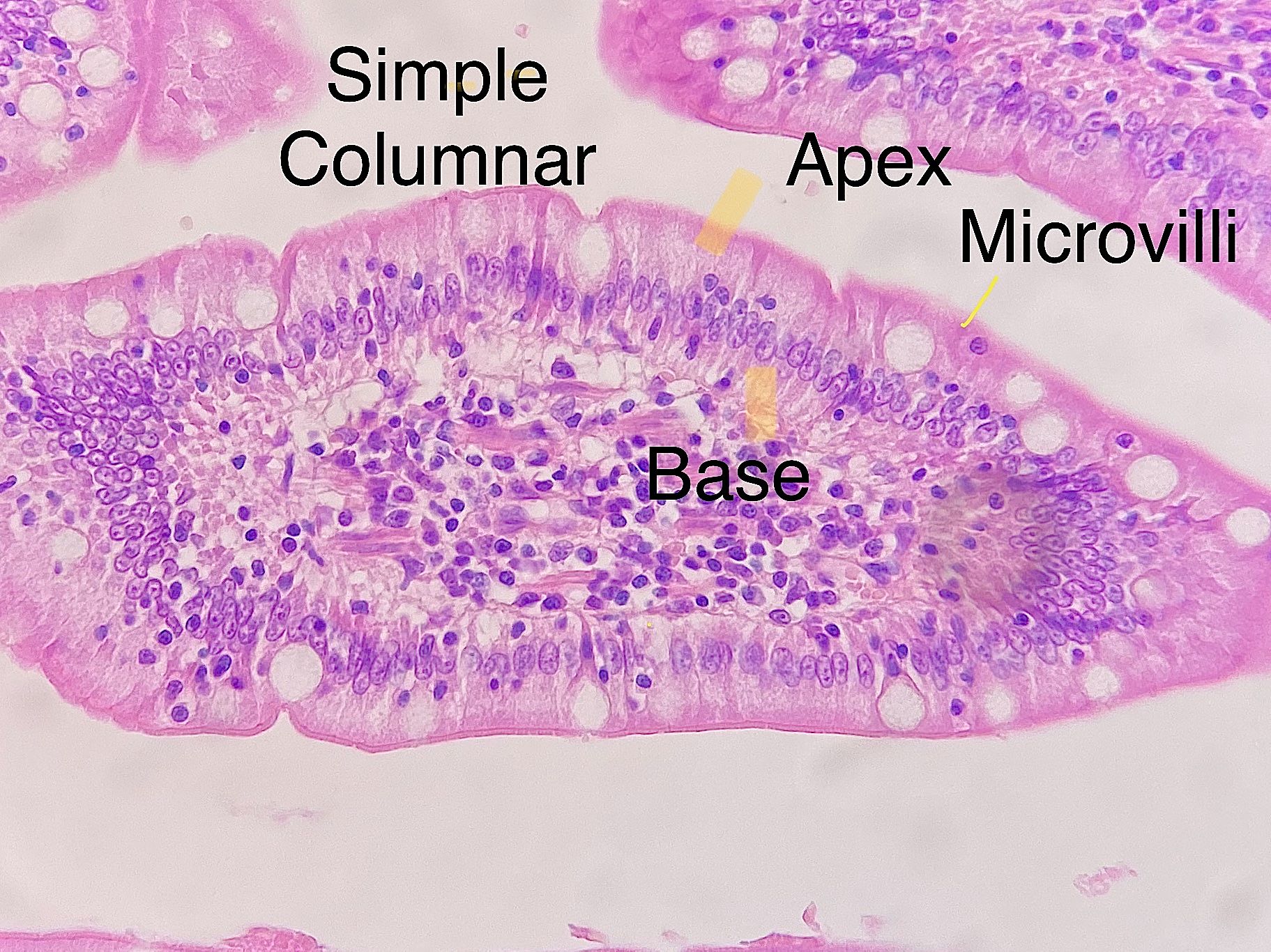 Simple columnar epithelium