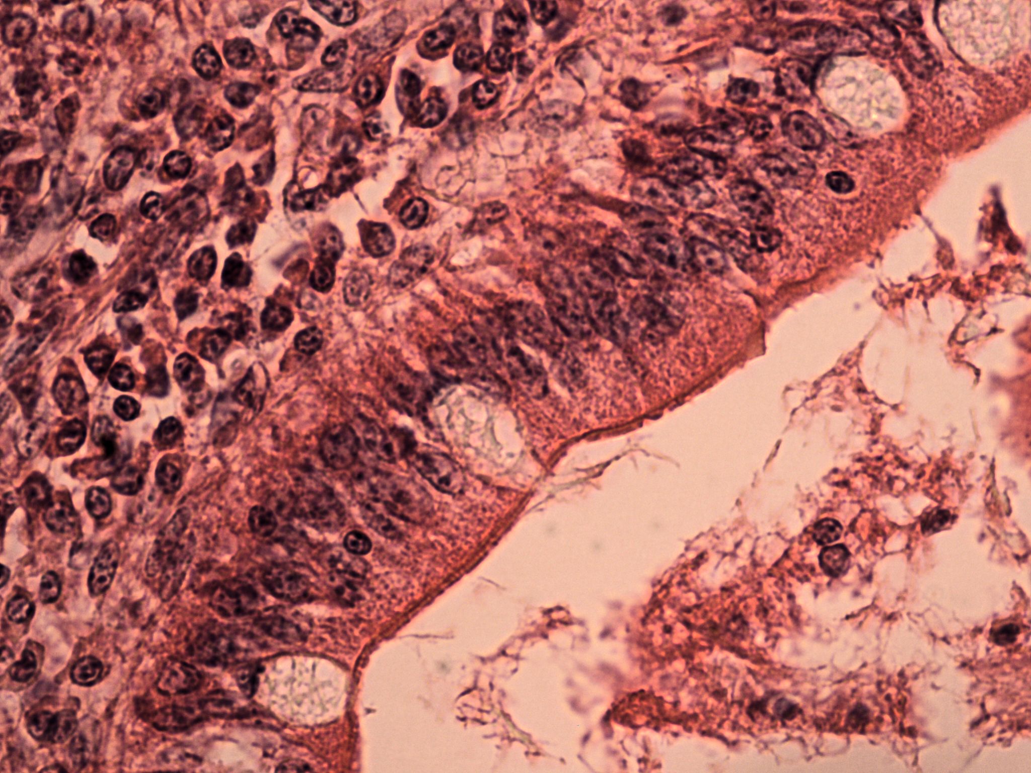 Simple columnar epithelium