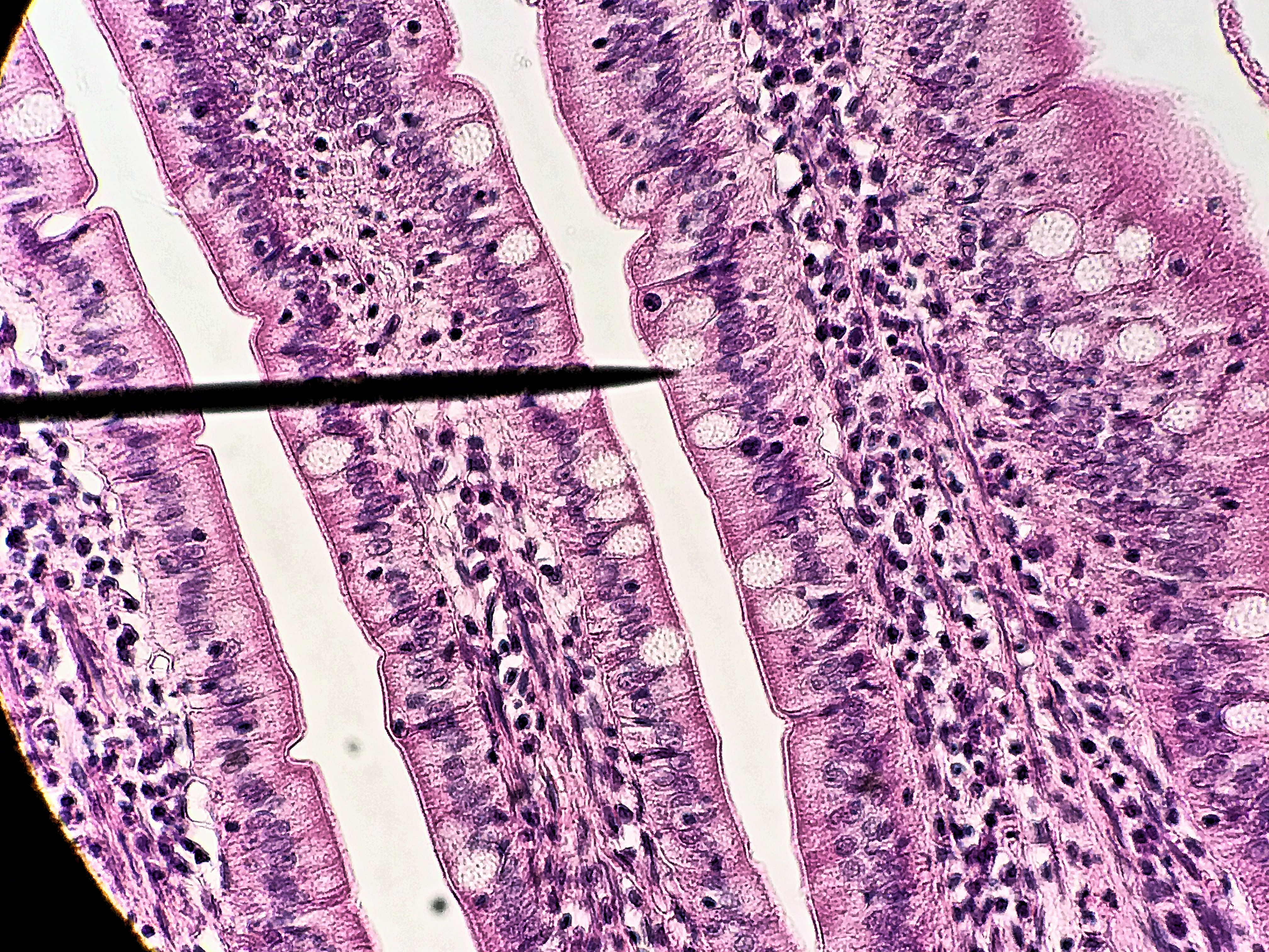 Simple columnar epithelium