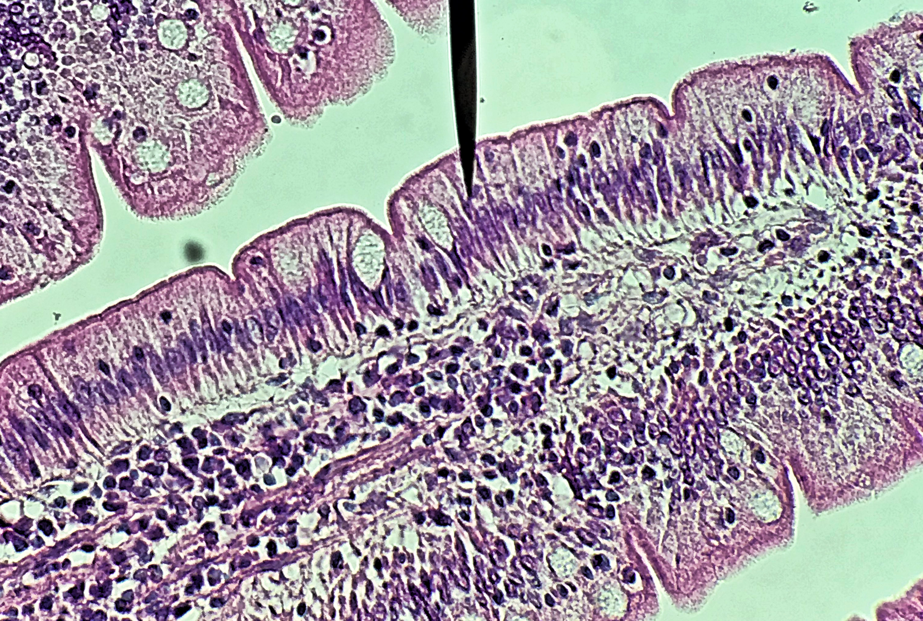 Simple columnar epithelium