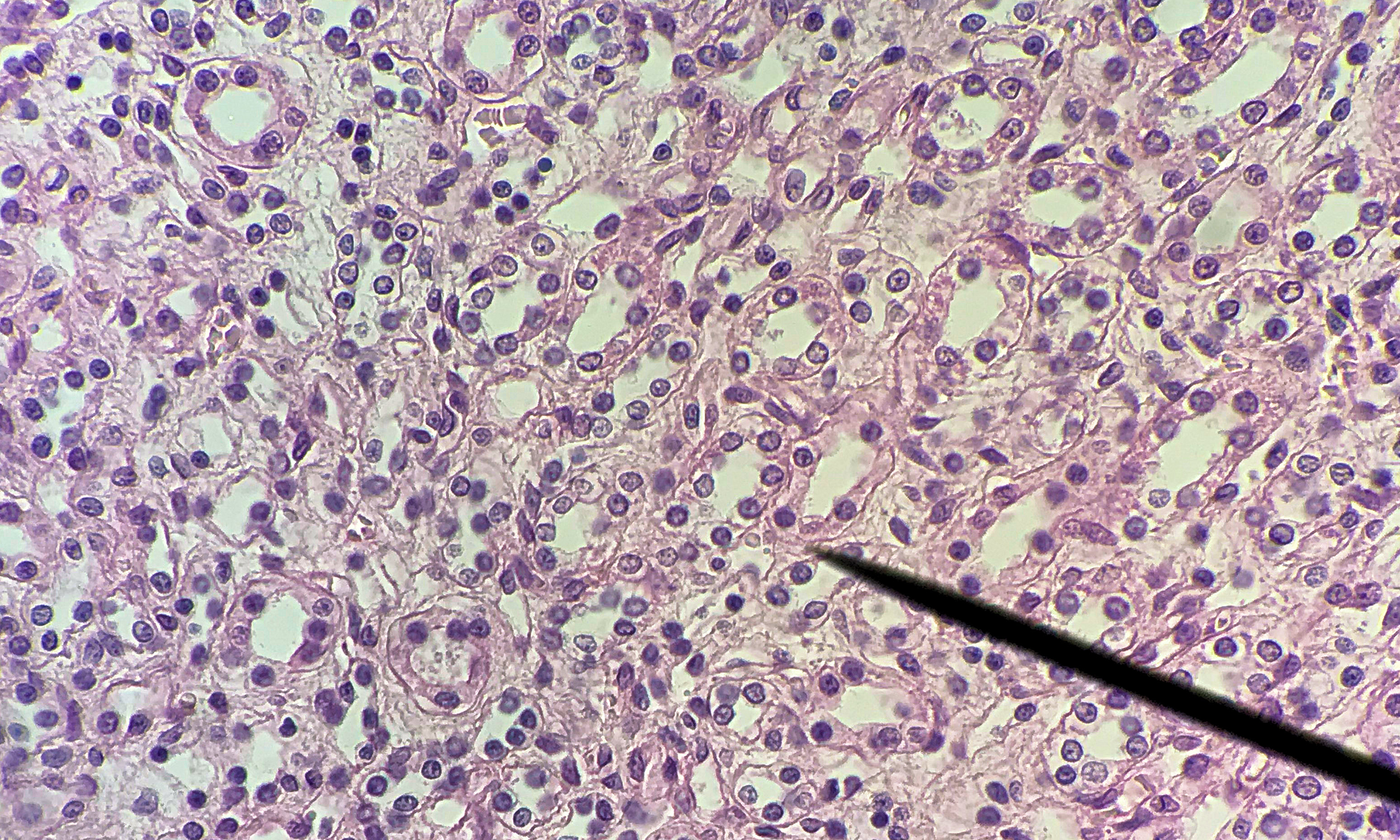 Simple cuboidal epithelium