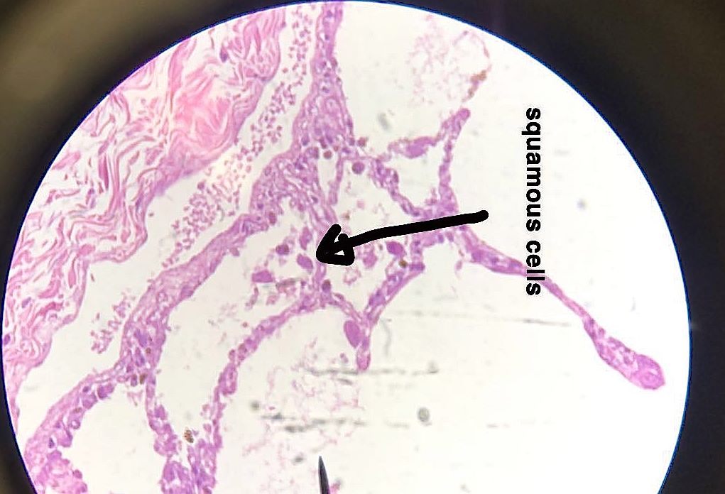 Simple squamous epithelium