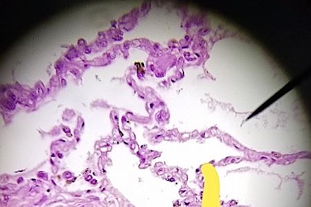 Simple squamous epithelium