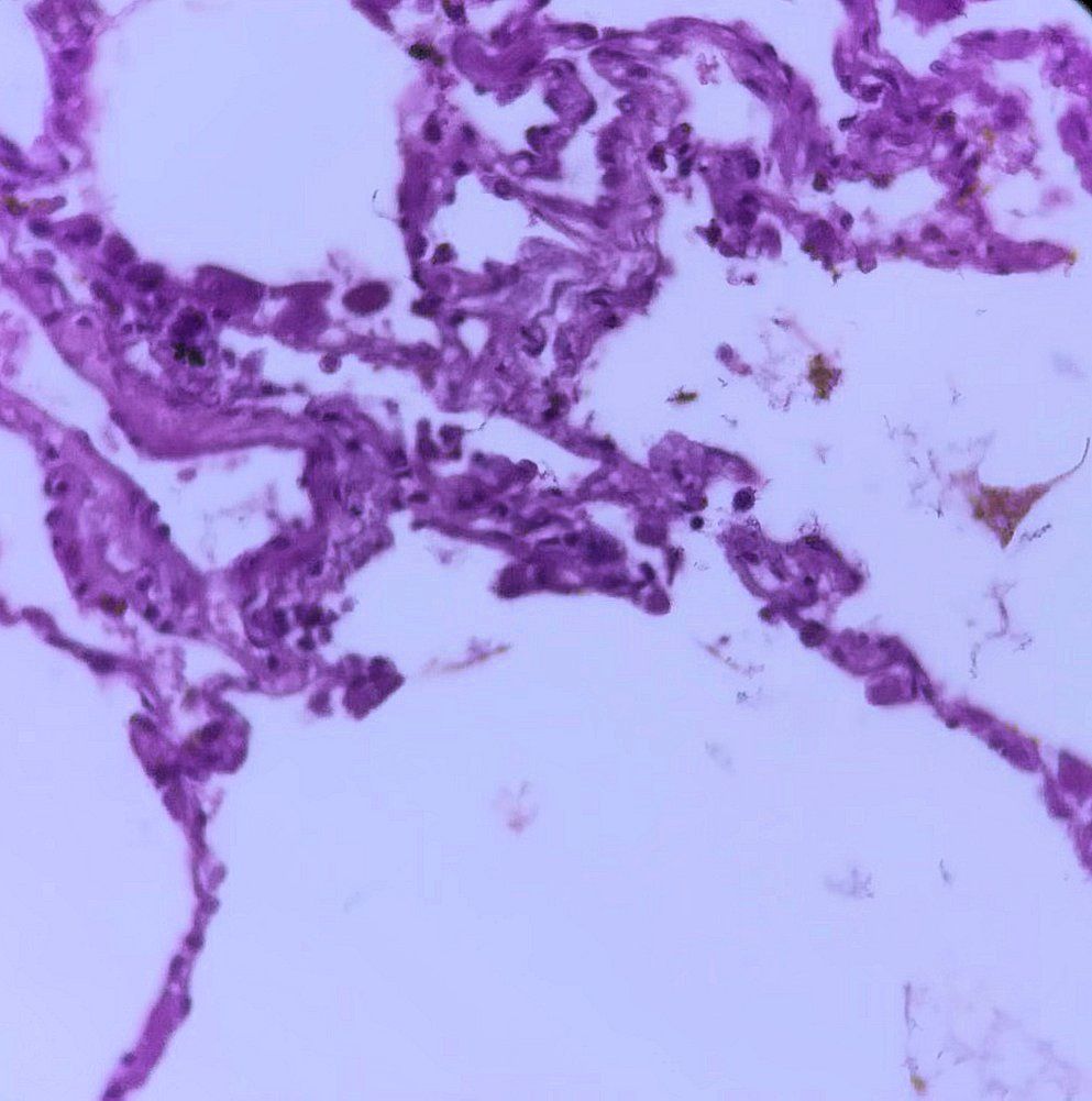 Simple squamous epithelium