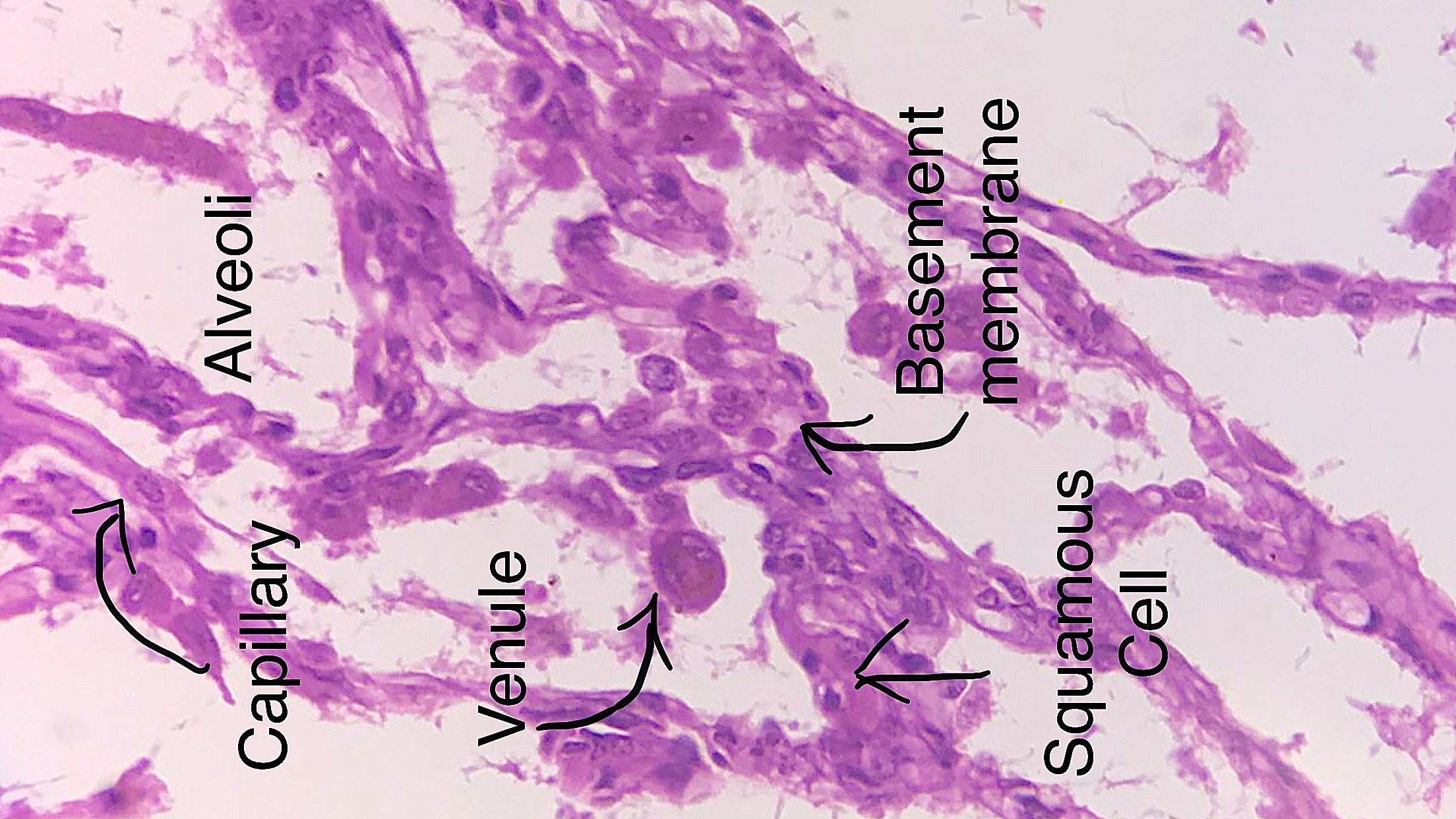 Simple squamous epithelium