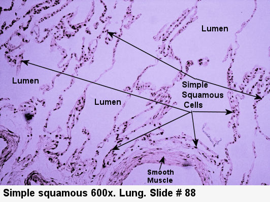 Simple squamous epithelium Labeled